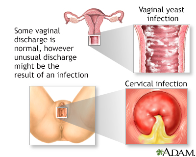 Normal Birth Pictures on Vaginal Discharge   Doctors Hospital