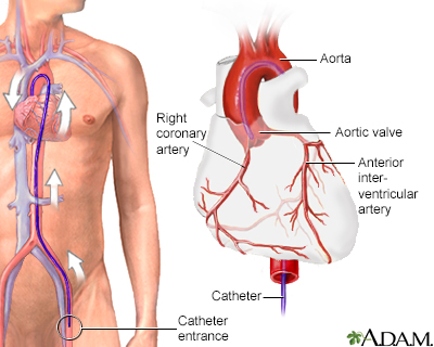 human veins and arteries diagram. pictures google human veins